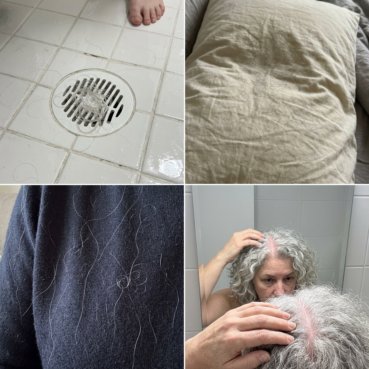 Hair loss evidence - shower drain, pillow, sweater, widening part